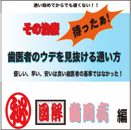 歯医者のウデを見抜ける通い方 歯周病偏